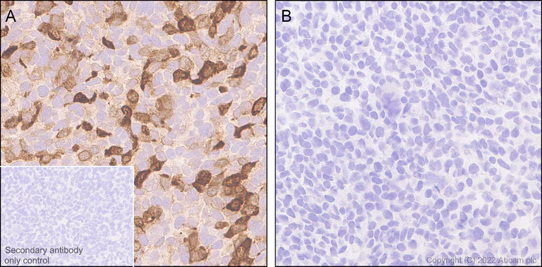 Immunohistochemistry (Formalin/PFA-fixed paraffin-embedded sections) - Anti-Bassoon/BSN antibody [L124-59] - BSA and Azide Free (AB306594)