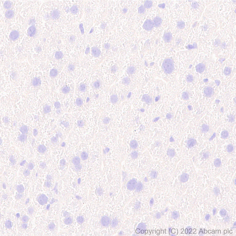 Immunohistochemistry (Formalin/PFA-fixed paraffin-embedded sections) - Anti-Bassoon/BSN antibody [L124-59] - BSA and Azide Free (AB306594)