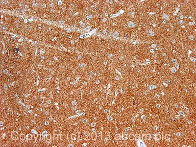 Immunohistochemistry (Formalin/PFA-fixed paraffin-embedded sections) - Anti-Bassoon/BSN antibody [SAP7F407] (AB82958)