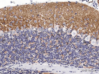 Immunohistochemistry (Formalin/PFA-fixed paraffin-embedded sections) - Anti-Bassoon/BSN antibody [SAP7F407] (AB82958)