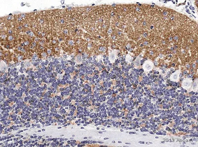 Immunohistochemistry (Formalin/PFA-fixed paraffin-embedded sections) - Anti-Bassoon/BSN antibody [SAP7F407] (AB82958)