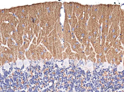 Immunohistochemistry (Formalin/PFA-fixed paraffin-embedded sections) - Anti-Bassoon/BSN antibody [SAP7F407] (AB82958)