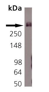 Western blot - Anti-Bassoon/BSN antibody [SAP7F407] (AB82958)