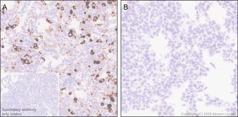 Immunohistochemistry (Formalin/PFA-fixed paraffin-embedded sections) - Anti-Bat coronavirus HKU5 Spike protein S1 (RBD domain) antibody [EPR31043-570] (AB326881)