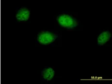 Immunocytochemistry/ Immunofluorescence - Anti-BAT3/BAG-6 antibody (AB88292)