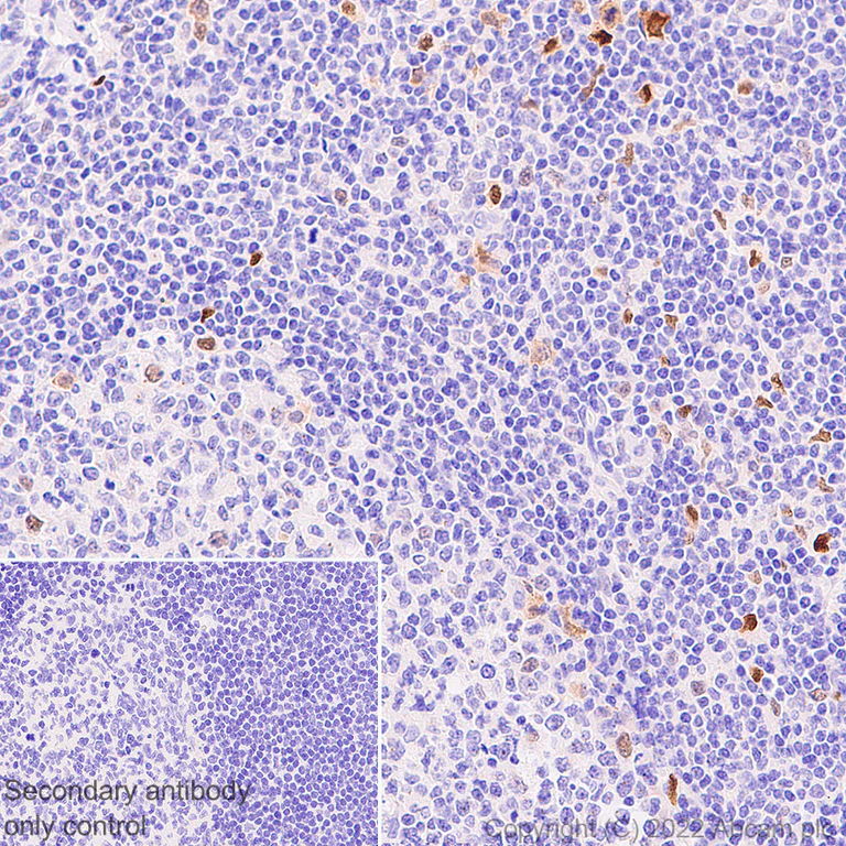 Immunohistochemistry (Formalin/PFA-fixed paraffin-embedded sections) - Anti-BATF3 antibody [EPR26558-38] (AB302568)