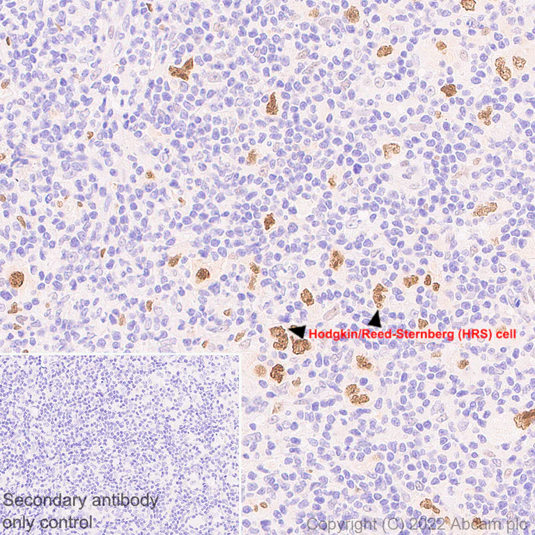 Immunohistochemistry (Formalin/PFA-fixed paraffin-embedded sections) - Anti-BATF3 antibody [EPR26558-38] - BSA and Azide free (AB302569)