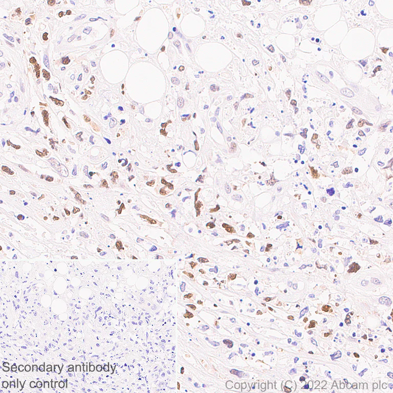 Immunohistochemistry (Formalin/PFA-fixed paraffin-embedded sections) - Anti-BATF3 antibody [EPR26558-38] - BSA and Azide free (AB302569)