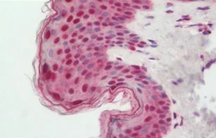 Immunohistochemistry (Formalin/PFA-fixed paraffin-embedded sections) - Anti-BATF3 antibody - N-terminal (AB211304)