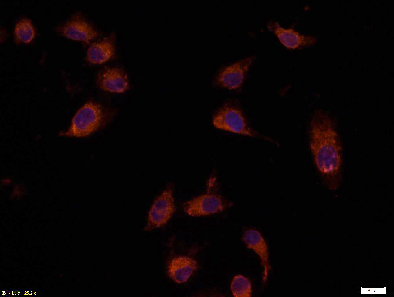 Immunocytochemistry/ Immunofluorescence - Anti-Bax antibody (AB216494), expandable thumbnail