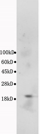 Western blot - Anti-Bax antibody (AB216494), expandable thumbnail