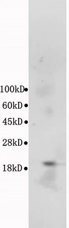 Western blot - Anti-Bax antibody (AB216494)