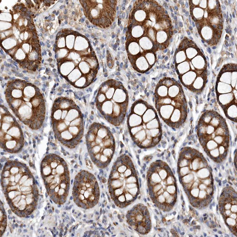 Immunohistochemistry (Formalin/PFA-fixed paraffin-embedded sections) - Anti-Bax antibody (AB262929)