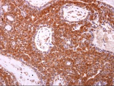 Immunohistochemistry (Formalin/PFA-fixed paraffin-embedded sections) - Anti-Bax antibody (AB263897)
