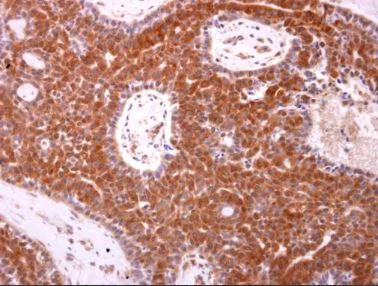 Immunohistochemistry (Formalin/PFA-fixed paraffin-embedded sections) - Anti-Bax antibody (AB263897)