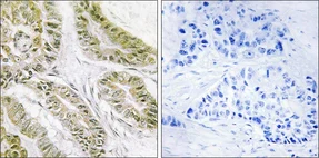 Immunohistochemistry (Formalin/PFA-fixed paraffin-embedded sections) - Anti-Bax antibody (AB53154)