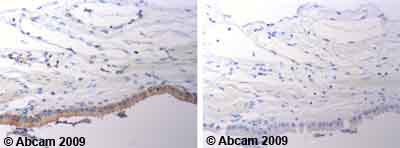 Immunohistochemistry (Formalin/PFA-fixed paraffin-embedded sections) - Anti-Bax antibody (AB53154)