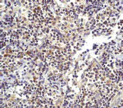 Immunohistochemistry (Formalin/PFA-fixed paraffin-embedded sections) - Anti-Bax antibody [E63] - BSA and Azide free (AB216985)