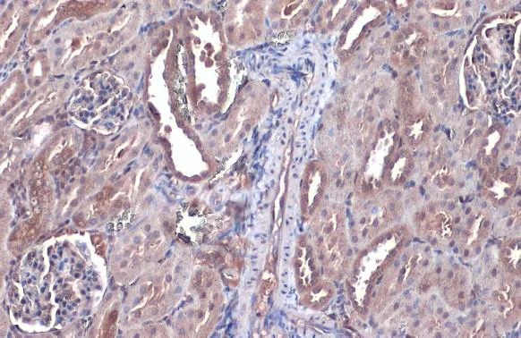 Immunohistochemistry (Formalin/PFA-fixed paraffin-embedded sections) - Anti-Bax antibody [HL236] - BSA and Azide free (AB289364)