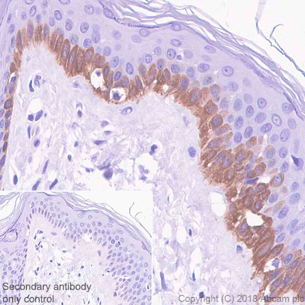 Immunohistochemistry (Formalin/PFA-fixed paraffin-embedded sections) - Anti-Bax antibody [SP47] (AB81083)
