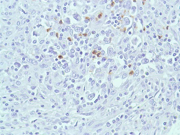 Immunohistochemistry (Formalin/PFA-fixed paraffin-embedded sections) - Anti-Bax antibody [SP47] (AB81083)