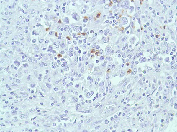 Immunohistochemistry (Formalin/PFA-fixed paraffin-embedded sections) - Anti-Bax antibody [SP47] (AB81083)
