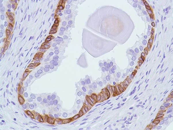 Immunohistochemistry (Formalin/PFA-fixed paraffin-embedded sections) - Anti-Bax antibody [SP47] (AB81083)