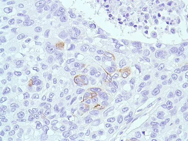Immunohistochemistry (Formalin/PFA-fixed paraffin-embedded sections) - Anti-Bax antibody [SP47] (AB81083)