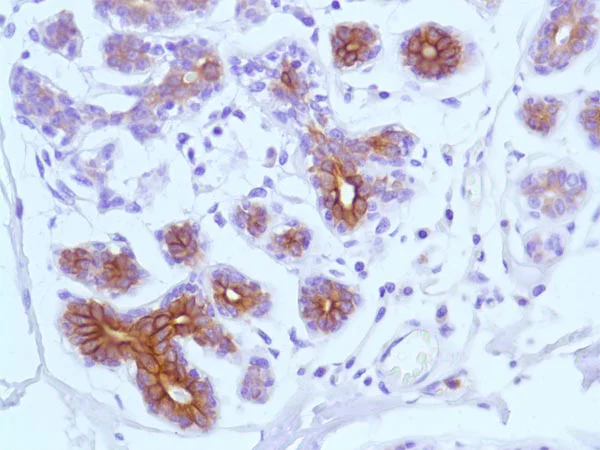 Immunohistochemistry (Formalin/PFA-fixed paraffin-embedded sections) - Anti-Bax antibody [SP47] (AB81083)