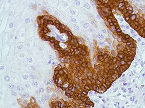 Immunohistochemistry (Formalin/PFA-fixed paraffin-embedded sections) - Anti-Bax antibody [SP47] (AB81083)