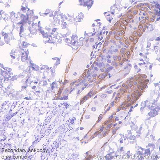 Immunohistochemistry (Formalin/PFA-fixed paraffin-embedded sections) - Anti-Bax antibody [SP47] (AB81083)