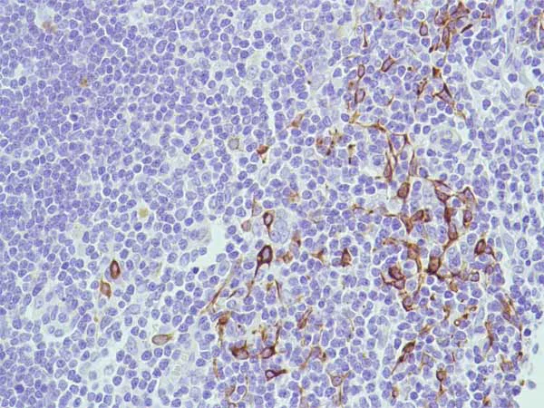 Immunohistochemistry (Formalin/PFA-fixed paraffin-embedded sections) - Anti-Bax antibody [SP47] (AB81083)