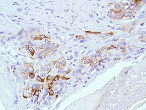 Immunohistochemistry (Formalin/PFA-fixed paraffin-embedded sections) - Anti-Bax antibody [SP47] (AB81083)