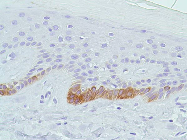 Immunohistochemistry (Formalin/PFA-fixed paraffin-embedded sections) - Anti-Bax antibody [SP47] (AB81083)