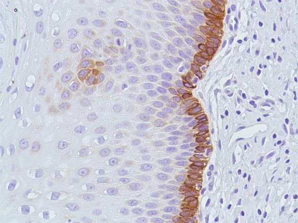 Immunohistochemistry (Formalin/PFA-fixed paraffin-embedded sections) - Anti-Bax antibody [SP47] - BSA and Azide free (AB240930)