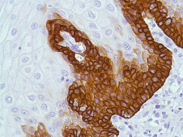 Immunohistochemistry (Formalin/PFA-fixed paraffin-embedded sections) - Anti-Bax antibody [SP47] - BSA and Azide free (AB240930)