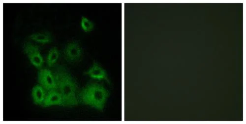 Immunocytochemistry/ Immunofluorescence - Anti-Bax (phospho T167) antibody (AB192819)