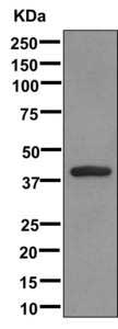 Western blot - Anti-BBOX1 antibody [EPR11309] (AB171959), expandable thumbnail