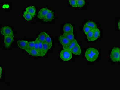 Immunocytochemistry/ Immunofluorescence - Anti-BBS1 antibody (AB222890)