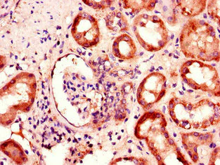 Immunohistochemistry (Formalin/PFA-fixed paraffin-embedded sections) - Anti-BBS1 antibody (AB222890)