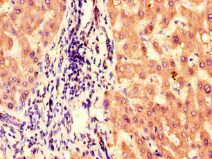 Immunohistochemistry (Formalin/PFA-fixed paraffin-embedded sections) - Anti-BBS1 antibody (AB222890)