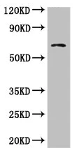 Western blot - Anti-BBS1 antibody (AB222890)