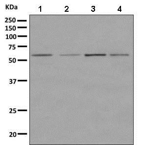 Western blot - Anti-BBS1 antibody [EPR7906] (AB166613)