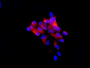 Immunocytochemistry/ Immunofluorescence - Anti-BBS1 antibody [EPR7906] - BSA and Azide free (AB236070)