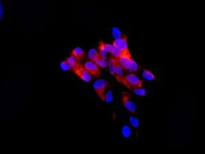 Immunocytochemistry/ Immunofluorescence - Anti-BBS1 antibody [EPR7906] - BSA and Azide free (AB236070)