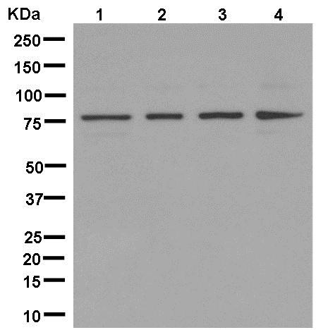 Western blot - Anti-BBS2 antibody [EPR13183] (AB181134), expandable thumbnail