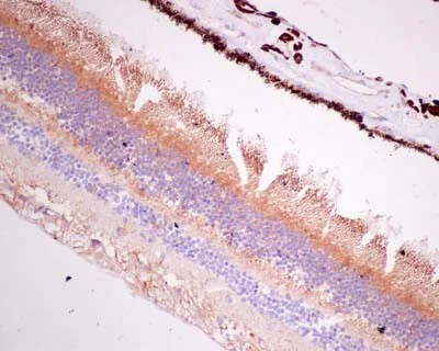 Immunohistochemistry (Formalin/PFA-fixed paraffin-embedded sections) - Anti-BBS2 antibody [EPR13183] - BSA and Azide free (AB250371)