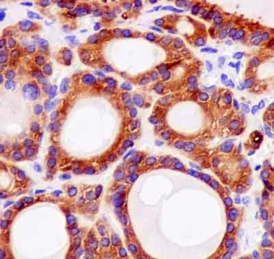 Immunohistochemistry (Formalin/PFA-fixed paraffin-embedded sections) - Anti-BBS2 antibody [EPR13183] - BSA and Azide free (AB250371)