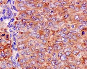 Immunohistochemistry (Formalin/PFA-fixed paraffin-embedded sections) - Anti-BBS2 antibody [EPR13183] - BSA and Azide free (AB250371)