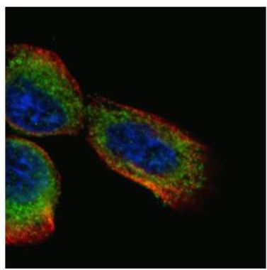 Immunocytochemistry/ Immunofluorescence - Anti-BCAR1 antibody (AB137507), expandable thumbnail